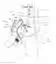 Fig. 01 - Curved tibiotalar fusion nail and method of use