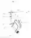 Fig. 06 - Curved tibiotalar fusion nail and method of use