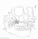 Fig. 01 - Hinged fixation devices for combined upper jaw correction