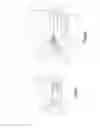 Fig. 04 - Hinged fixation devices for combined upper jaw correction