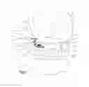 Fig. 17 - Hinged fixation devices for combined upper jaw correction