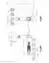 Fig. 21 - Hinged fixation devices for combined upper jaw correction