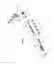 Fig. 26 - Hinged fixation devices for combined upper jaw correction
