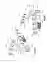 Fig. 28 - Hinged fixation devices for combined upper jaw correction