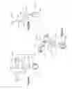 Fig. 29 - Hinged fixation devices for combined upper jaw correction