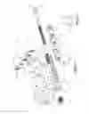 Fig. 31 - Hinged fixation devices for combined upper jaw correction