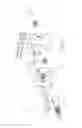 Fig. 37 - Hinged fixation devices for combined upper jaw correction