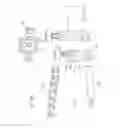 Fig. 44 - Hinged fixation devices for combined upper jaw correction