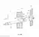 Fig. 48 - Hinged fixation devices for combined upper jaw correction