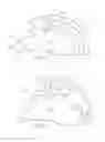 Fig. 50 - Hinged fixation devices for combined upper jaw correction