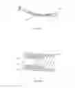 Fig. 55 - Hinged fixation devices for combined upper jaw correction