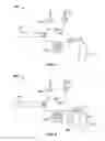 Fig. 08 - Pressure modulated cryoablation system and related methods