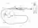 Fig. 01 - Diagnostic guidewire for cryoablation sensing and pressure monitoring