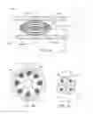 Fig. 05 - Medical device for treating airways and related methods of use