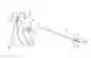 Fig. 01 - Deployment mechanisms for surgical instruments