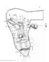 Fig. 07 - Deployment mechanisms for multi-function surgical instruments
