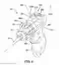 Fig. 09 - Energy delivery device having a translating outer sheath