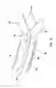 Fig. 07 - Systems and methods for percutaneous intravascular access for arteriovenous fistula