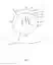 Fig. 08 - Vaginal remodeling device and methods