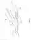Fig. 09 - Vaginal remodeling device and methods