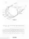 Fig. 10 - Vaginal remodeling device and methods