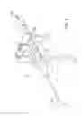 Fig. 02 - Electrosurgical electrode
