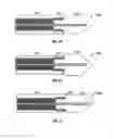 Fig. 19 - High-strength microwave antenna assemblies