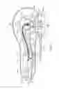 Fig. 06 - SYSTEMS, APPARATUS, METHODS AND PROCEDURES FOR THE NONINVASIVE TREATMENT OF TISSUE USING MICROWAVE ENERGY