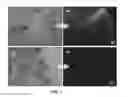 Fig. 02 - METHOD FOR DEPILATION BY PHOTOTHERMOLYSIS WITH MELANIN