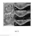 Fig. 09 - SYSTEMS AND METHODS FOR IMAGING AND MANIPULATING TISSUE