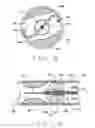 Fig. 06 - Expandable laser catheter