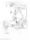 Fig. 02 - Aiming beam detection for safe laser lithotripsy