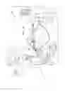 Fig. 05 - Aiming beam detection for safe laser lithotripsy