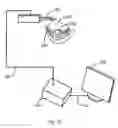 Fig. 16 - SYSTEM AND METHOD FOR REAL TIME TRACKING AND MODELING OF SURGICAL SITE