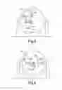 Fig. 05 - Robotic surgical station
