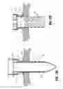 Fig. 20 - Articulating surgical access system for laparoscopic surgery