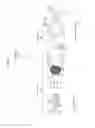 Fig. 02 - MEDICAL MANIPULATOR