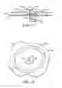 Fig. 08 - Method and apparatus pertaining to a medical drape having a suction port