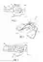 Fig. 02 - GLOTTO-MANDIBULAR ARCHES DEVICE FOR TMJ DISEASE