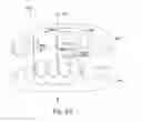 Fig. 09 - Digital dental modeling
