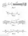 Fig. 03 - INTERARCH FORCE MODULE WITH LINK FOR ORTHODONTIC TREATMENT