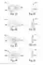 Fig. 06 - INTERARCH FORCE MODULE WITH LINK FOR ORTHODONTIC TREATMENT