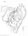 Fig. 12 - Self-ligating bracket