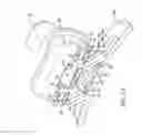 Fig. 14 - Self-ligating bracket