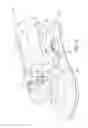Fig. 15 - Self-ligating bracket