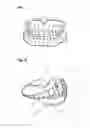 Fig. 02 - Apparatus and methods of making denture devices