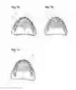 Fig. 06 - Apparatus and methods of making denture devices