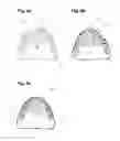 Fig. 07 - Apparatus and methods of making denture devices