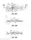 Fig. 25 - Dental floss