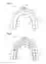 Fig. 04 - Tooth bleaching device